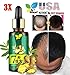 Hair Growth Essence Hair Regrow 7 Day, STCORPS7 Ginger Germinal Essential Oil Hair Growth Hair Loss Treatment Hair Care Hair Growth Serum for Men & Womenthumb 1