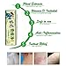 StarMade Rose Herbal Cream with Vitamin D Packs Ointment Skin Irritation Dryness Discomfort Itch