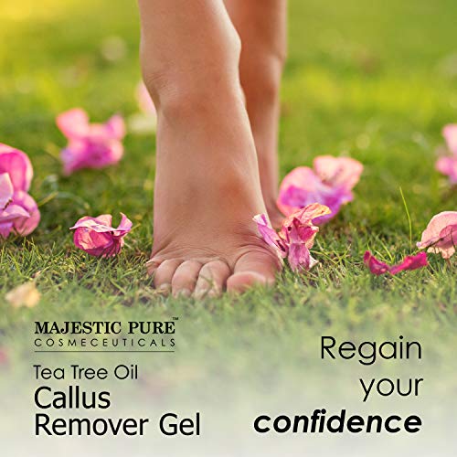 Callus Remover for Feet by Majestic Pure Gel with Tea Tree Oil for