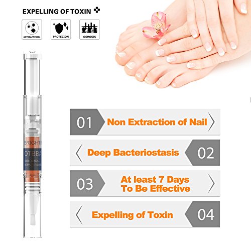 OTBBA Toenails & Fingernails Repair, Toenails Treatment Pens, Effective Personal Care Supply, 4 Pcs (4)