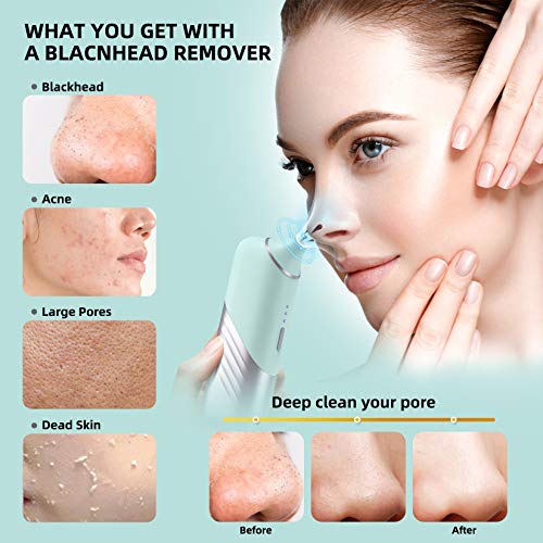 Visual Blackhead Remover，Pore Vacuum Blackhead Remover with Camera Rechargeable with 3 Speeds Adjustment and 4 beauty Heads Blackhead Suction Tool