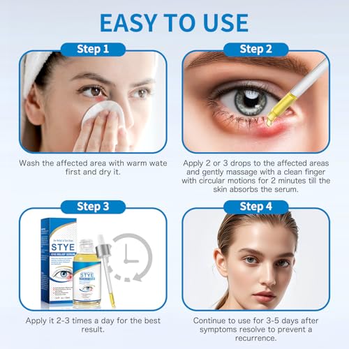 Stye Eye Treatment, Natural Stye Relief Serum for Chalazion, Blepharitis & Eyelid Bump, Gentle Soothing Eye Care for Swelling Redness Irritation (30 ml)