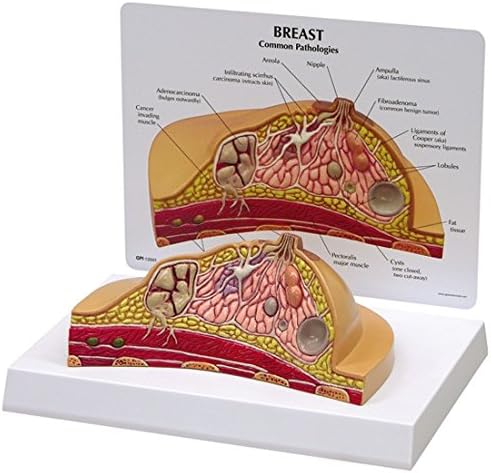 Breast Cross Section Anatomical Model w Educational Key Card
