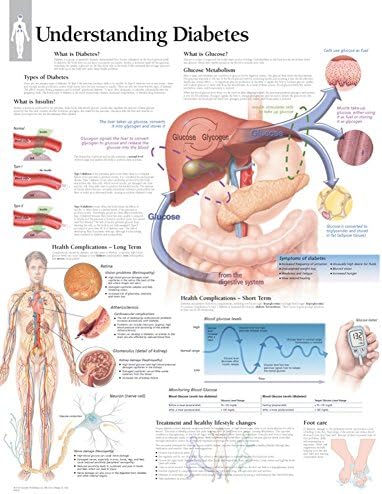 Laminated Understanding Diabetes Educational Chart Poster Laminated Poster 22 x 28in with Poster Hanger