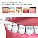 Electric Sonic Dental Calculus Plaque Remover Tools,homgeek Scraper Plaque Tartar Remover Dental Teeth Cleaning,5-in-1 LED Tooth Stain Polisher with Base,Teeth Oral Hygiene Dental Cleaning Tools