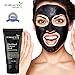 Blackhead Remover Mask by Pureauty Naturals - USA Made Black Mask | With Vitamins & Plants Extracts | Eliminate Impurities & Dead Cells, Tighten Pores, Cleanse & Smoothen Skin