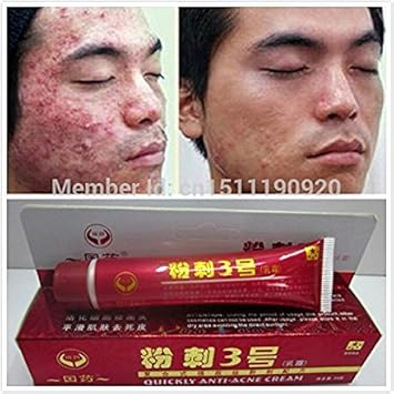 acne lightening cream