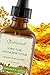 Psoriasis Scalp Anti Bacterial Fungal Formula