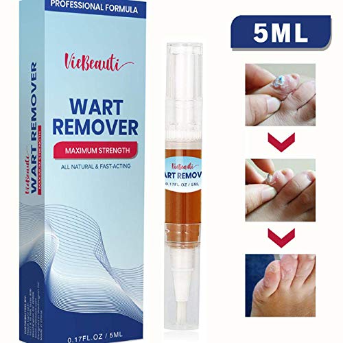 Wart Remover, Plantar Wart Remover, Foot Wart Remover, Corn Callus Remover, Wart Remover Liquid, Common and Plantar Warts Treatment by VieBeauti