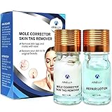 Wart Remover, Plantar Wart Remover, Foot Wart Remover, Corn Callus Remover, Wart Remover Liquid, Common and Plantar Warts Treatment by VieBeauti
