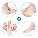 Yosoo Bunion Sleeve Protector Metatarsal Toe Pad Forefoot Cushion Socks Bunion Booties for Women Men- Hallux Valgus, Hammertoe,Pain Relief, One Size