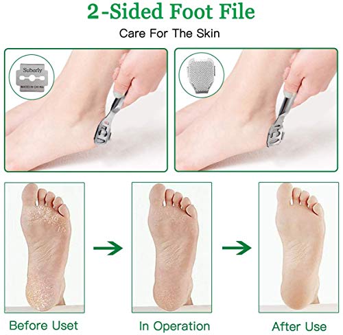 Foot Callus Remover, 12Pcs Stainless Steel Pedicure Rasp Foot Files Scraper Hard Skin Feet Callus Shaver Kit with Case, Foot Care Tool