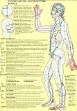 Image de Symptomatic Acupuncture Points