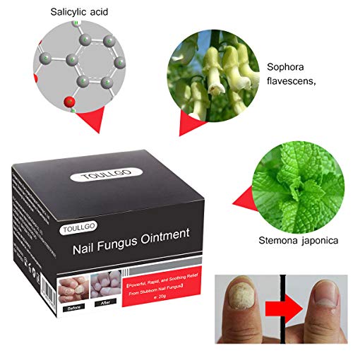 Nail Repair Solution, Nail Treatment, Onychomycosis Treatment, Onychomycosis Cream, Fingernails Repair, Effective Personal Care Supply, 20g