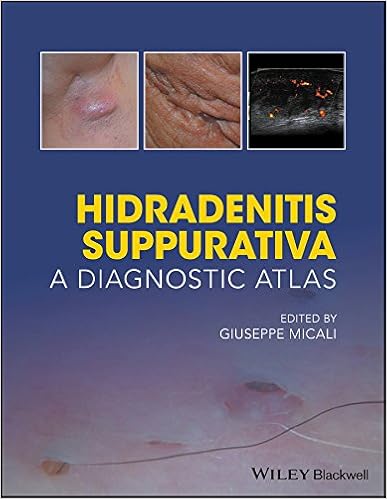 Hidradenitis Suppurativa A Diagnostic Atlas 9781119272953 Medicine Health Science Books Amazon Com