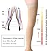 MGANG Thigh High Leg Sleeve 20-30 mmHg Graduated Compression with Grip Top, Medical Compression Stockings for Men and Women, with Varicose Veins, Lymphedema, Swelling & Venous Insufficiency, Beige L