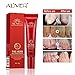2 Pcs Nail Fungus Treatment, Anti Fungus Nail Treatment, Foot Nail Repair Cream Protector Skin Care Cream, Herb Anti Fungal Nail Repair Cream, Removes Yellow from Infected Finger & Toe Nails