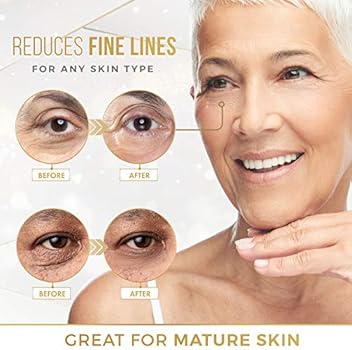fine line under eye treatment