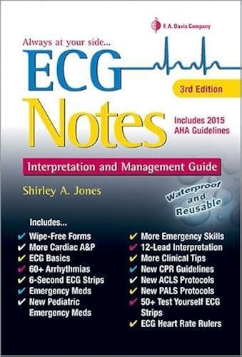 Download ECG Notes: Interpretation and Management Guide PDF