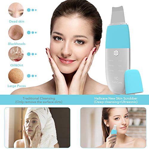 Skin Scrubber Ultrasonic Blackheads Remover Comedone Extractor