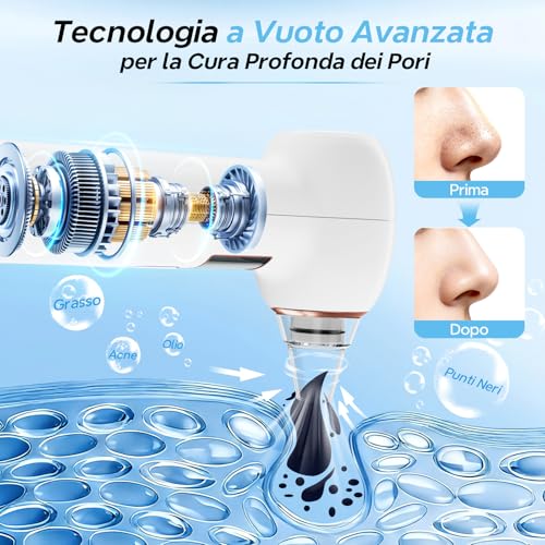 Aspiratore Punti Neri per Pulizia Viso Rimozione Punti Neri con 5 Testine Sottovuoto 4 Strumenti Manuali 3 Livelli di Aspirazione per Pelle Grassa Blackhead Remover Elettrico Portatile | 3 Livelli di Aspirazione,Elettrico Portatile, Tutti i Tipi di Pelle,Set di strumenti per la rimozione dei punti neri