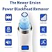 DOFLY Blackhead Remover, Skin Facial Pore Cleaner, Electric Blackhead Vacuum Suction Removal, Acne Comedone Extractor Tool Set, Comedo Microdermabrasion Exfoliating Machine for Women and Men