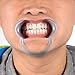 Dental Mouth Opener, Ganoteck Pack of 20 Dental Cheek Retractor Mouth Opener for Speak Out Game, Teeth Whitening Lip Retractor for Watch Ya Mouth and Adult Fun Games (S, M and L Size)