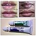 Pink Lips Cream Set 2 Tubes Derma Clinic Lightening Remove Dark Smoke Lips Balm