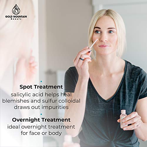 Acne Spot Treatment Drying Lotion - Face Cystic Acne Treatment, Zit