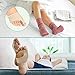 VINGVO Gel Bunion Corrector Toe Straightener 1 Pair Set, Big Toe Splint Protectors, Support Sleeve with Silicone Separators and Pad for Hallux Valgus Pain Relief Day and Night Time, Fleshcolor