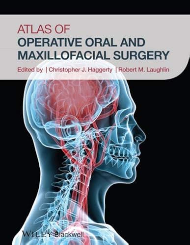 Download Atlas of Operative Oral and Maxillofacial Surgery PDF
