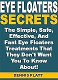Eye Floaters Secrets: The Simple, Safe, Effective, And Fast Eye Floaters Treatments That They Don't Want You To Know About!