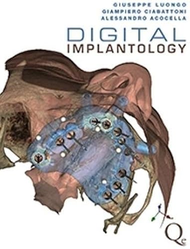 Download Digital Implantology PDF