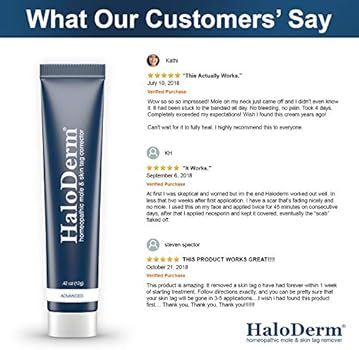 haloderm skin tag remover