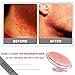 Exfoliating Brush, Body Brush, Eliminate Shaving Irritation for Face, Neck, Armpit, Bikini Line, Legs, To Treat and Prevent Razor Bumps and Ingrown Hairs for Men and Women (Orange)