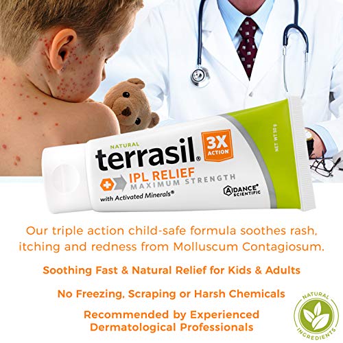 Molluscum Contagiosum Treatment with Thuja terrasil IPL Relief, Pain
