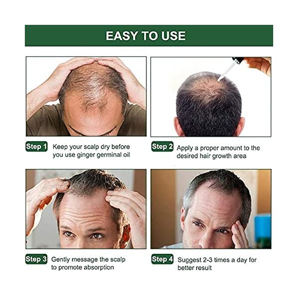 Ginger-Germinal-Oil-3-PACK2020-Hair-Growth-TreatmentHair-SerumAnti-Hair-Loss-Thinning-Balding-Repairs-Hair-Follicles-Promotes-Thicker-Stronger-Hair-And-Promotes-Hair-Regrowth Ginger Germinal Oil 3 PACK,2020 Hair Growth Treatment,Hair Serum,Anti Hair Loss, Thinning, Balding, Repairs Hair…