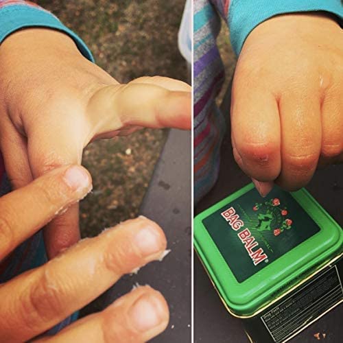 Bag Balm Vermont's Original Skin Moisturizer - Full Body Hydrating Skin Care: Dry Hands, Lips, Face, Feet & More - Unscented, Cruelty & Paraben Free - Day & Night, Men & Women (4oz Tin, Made in USA)