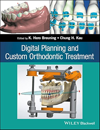 Download Digital Planning and Custom Orthodontic Treatment (English Edition) PDF