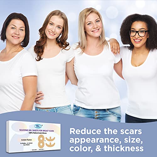 Breast silicone scar sheets. Breast Scar Treatment After Surgery 4