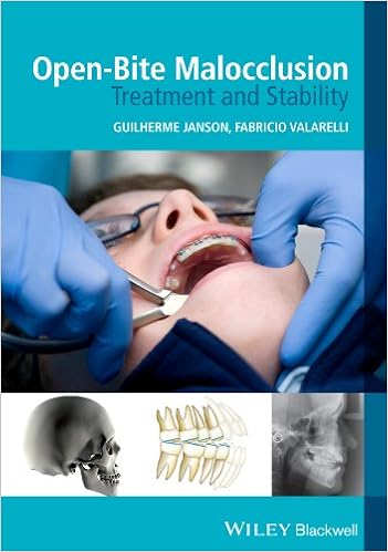 Open-Bite Malocclusion: Treatment and Stability Open-Bite Malocclusion: Treatment and Stability