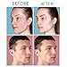 Bye Bye Blemish Acne Drying Lotion, On-the-Spot Pimple Treatment, Reduce Pimples Overnight, Beauty Skincare Essential - 1oz. (2-Pack)