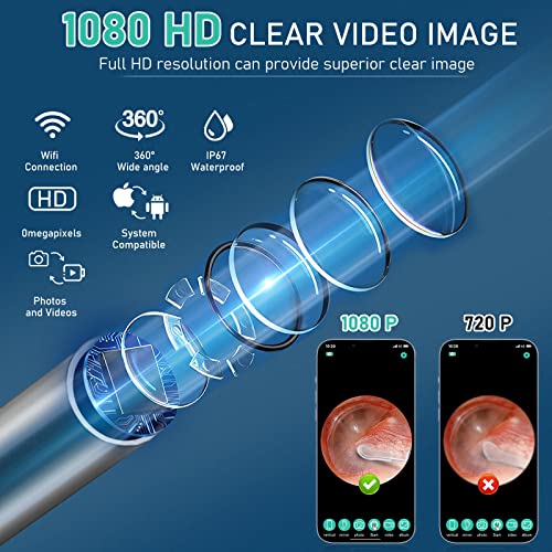 Ear Wax Removal Tool,Ear Cleaner Camera with 10 Pcs Ear Set,1080P HD Smart Rechargable,Ear Otoscope with 6 LED Lights Ear Cleaning Kit,Compatible with iPhone, Andriod Phones and Tablets(Black)