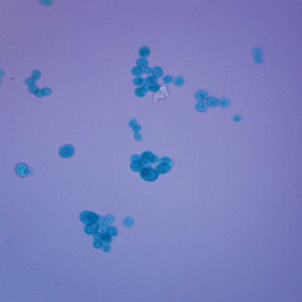 Chlorella, w.m. Microscope Slide Science Lab Microbiology Supplies