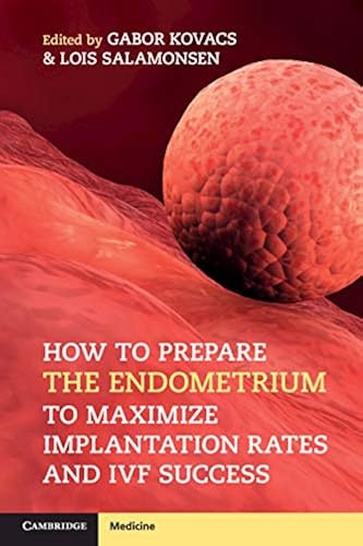 Download How to Prepare the Endometrium to Maximize Implantation Rates and IVF Success PDF