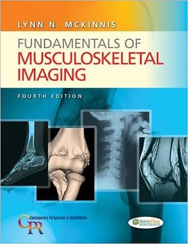 Fundamentals Of Musculoskeletal Imaging Contemporary - 