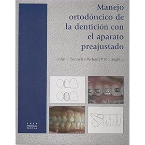 Orthodontic Management of the Dentition with the Preadjusted Appliance