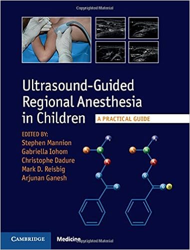 Ultrasound Guided Regional Anesthesia In Children A Practical Guide 9781107098770 Medicine Health Science Books Amazon Com