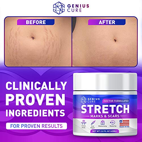 Stretch Marks & Scars Defense Cream Daily Moisturizer w Organic Shea