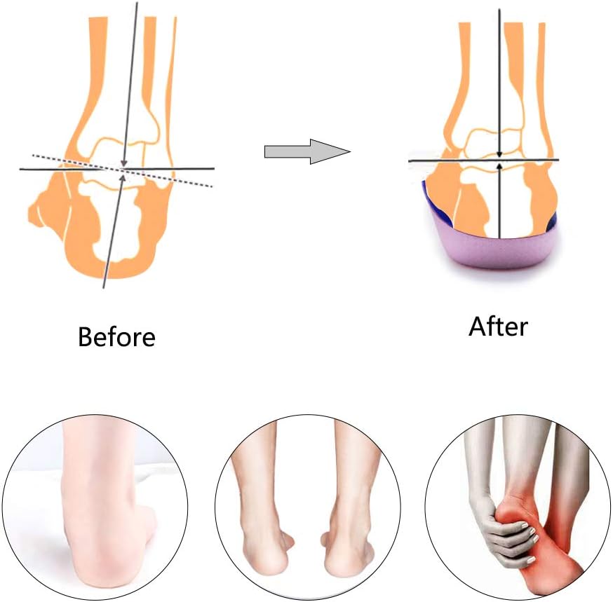 PCSsole 3/4 Orthotics Shoe Insoles High Arch Supports Shoe Inserts for Plantar Fasciitis, Flat Feet, Over-Pronation, Relief Heel Spur Pain  (S:Men5-6/Women6-7): Health & Personal Care
